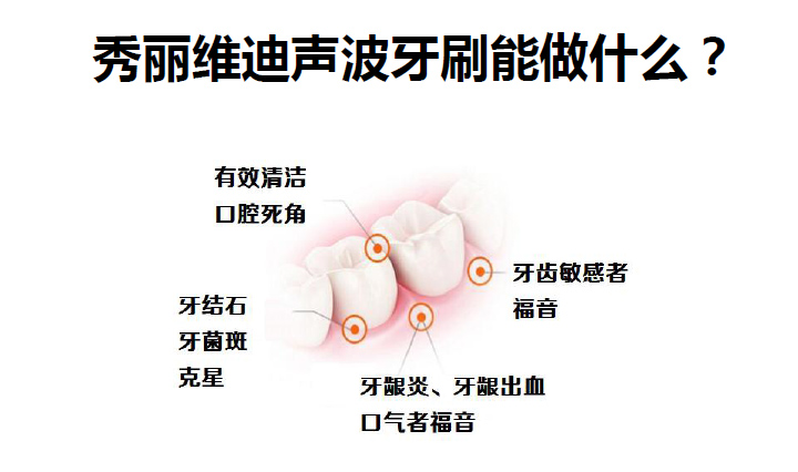 秀麗維迪聲波牙刷（感應(yīng)式/干電池）成人聲波牙刷、兒童聲波牙刷